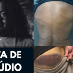 PM usa cassetete contra ex-jogador Perdigão; policial é afastado e passará por avaliação psicológica