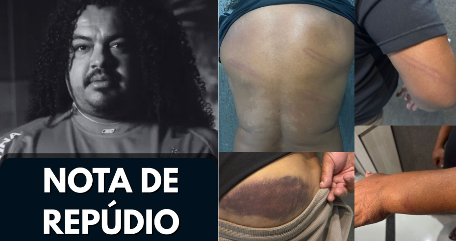Montagem com foto do ex-jogador Perdigão em preto e branco e imagens de hematomas e marcas de agressão em diferentes partes do corpo, denunciando violência policial durante partida de futebol no Paraná.